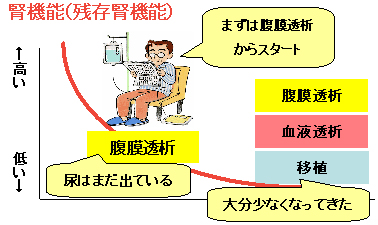 PDファーストの概念