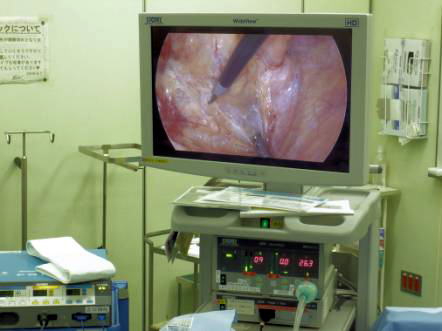 テレビモニターと気腹（おなかのなかに二酸化炭素を送り込む）装置