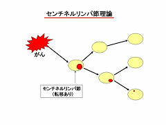 センチネルリンパ節理論