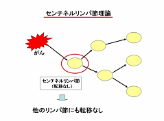 センチネルリンパ節理論