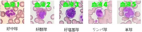 白血球標本画像