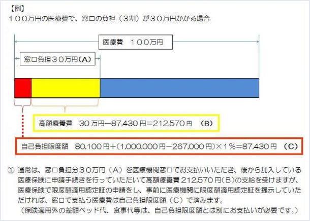 限度額適用認定証とは