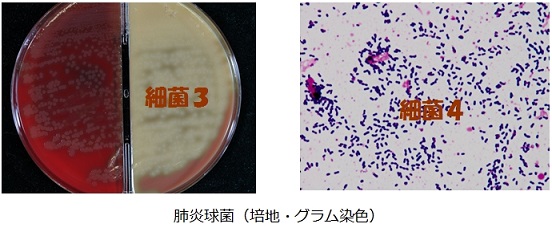 培地、細菌標本
